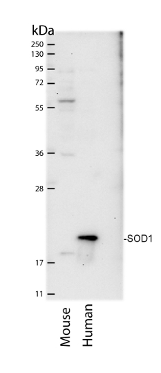 western blot using anti-SOD1 antibodies